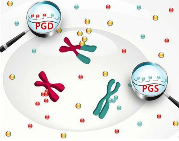 三代试管PGD诊断单基因疾病的流程与最新进展