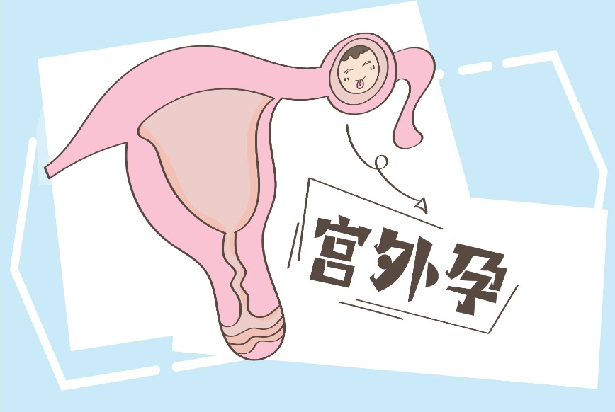 避免宫外孕，让试管婴儿求子梦想更近一步