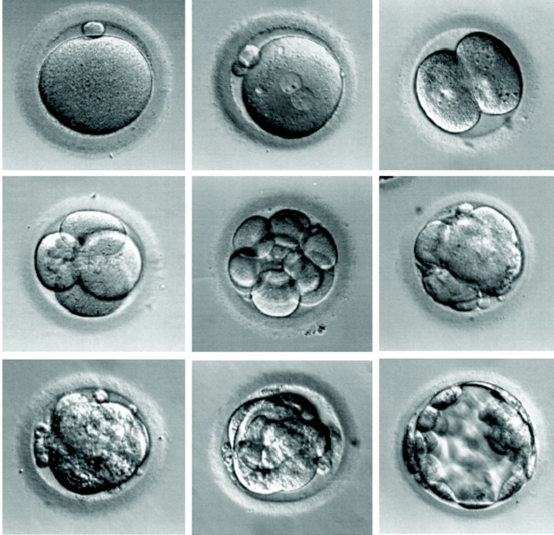 和宸浅谈试管胚胎等级怎么划分有什么标准？