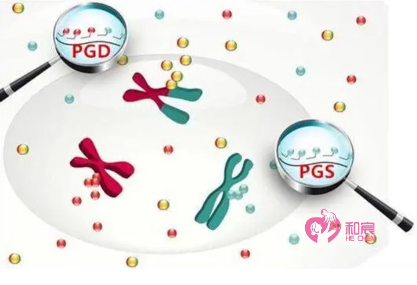 三代试管婴儿技术PGD与PGS